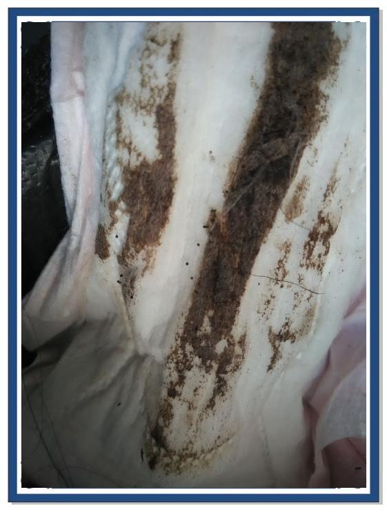 月经什么颜色正常