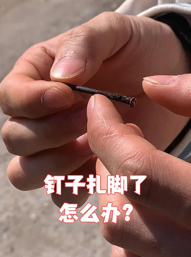 铁钉扎脚后如何处理