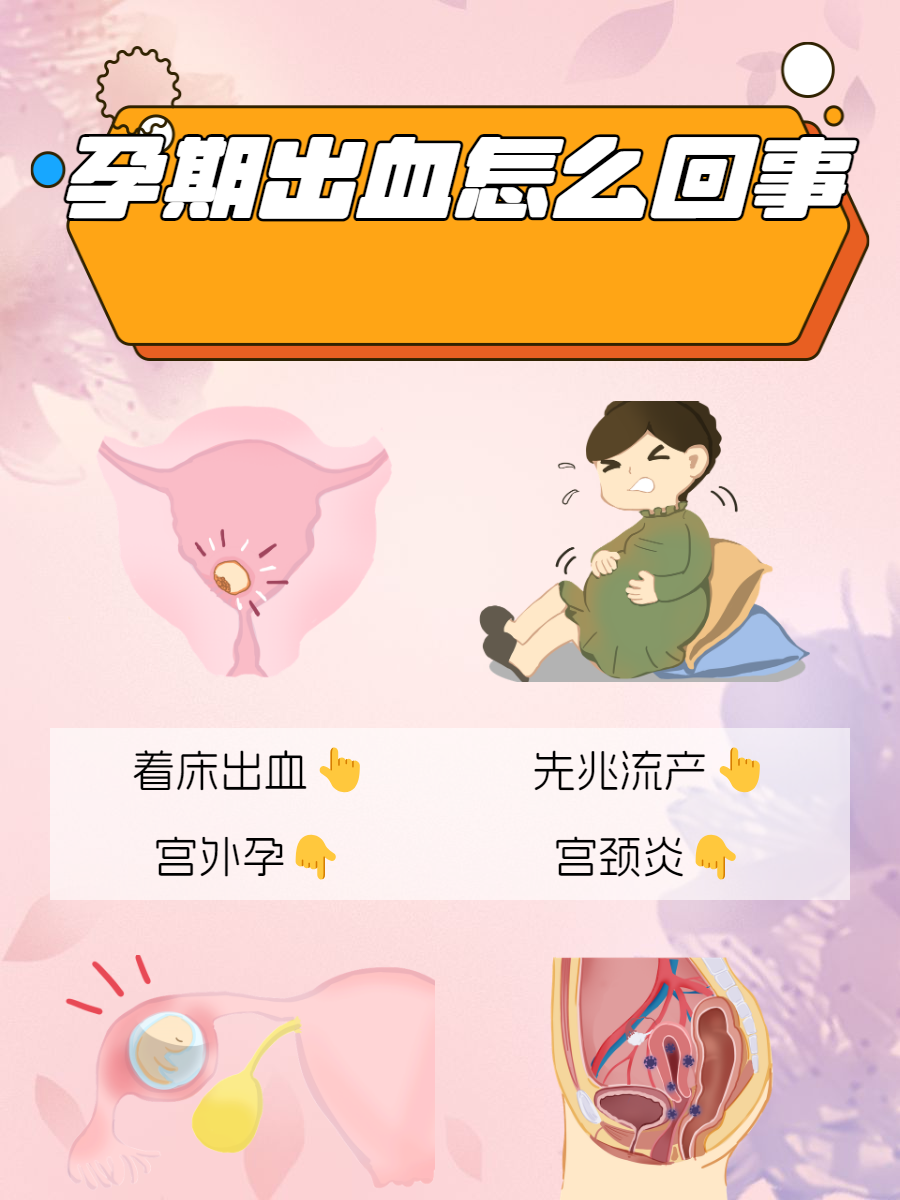 先兆流产的原因有哪些