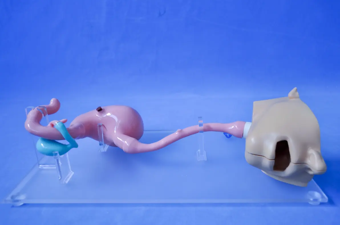 造影剂如何排出体外