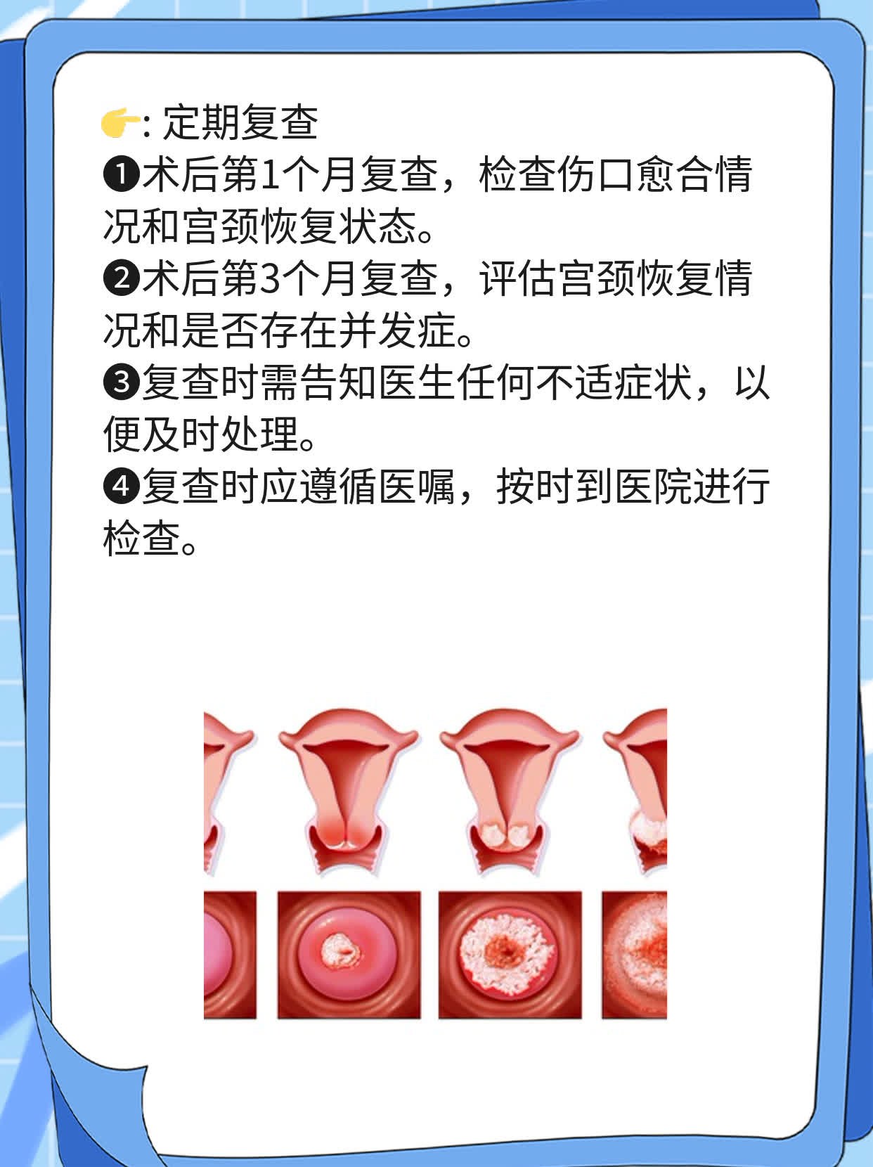 宫颈糜烂手术后会复发吗?