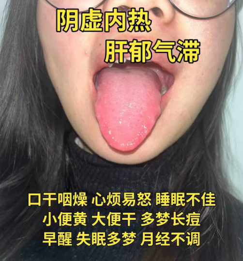 舌苔发黄怎么办