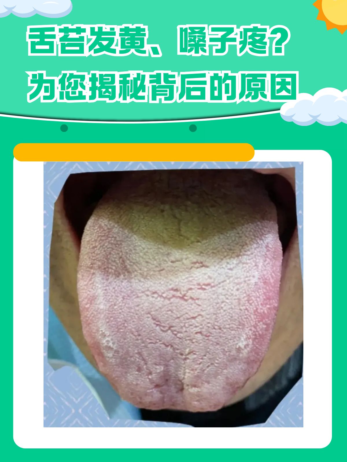 舌苔发黄怎么办