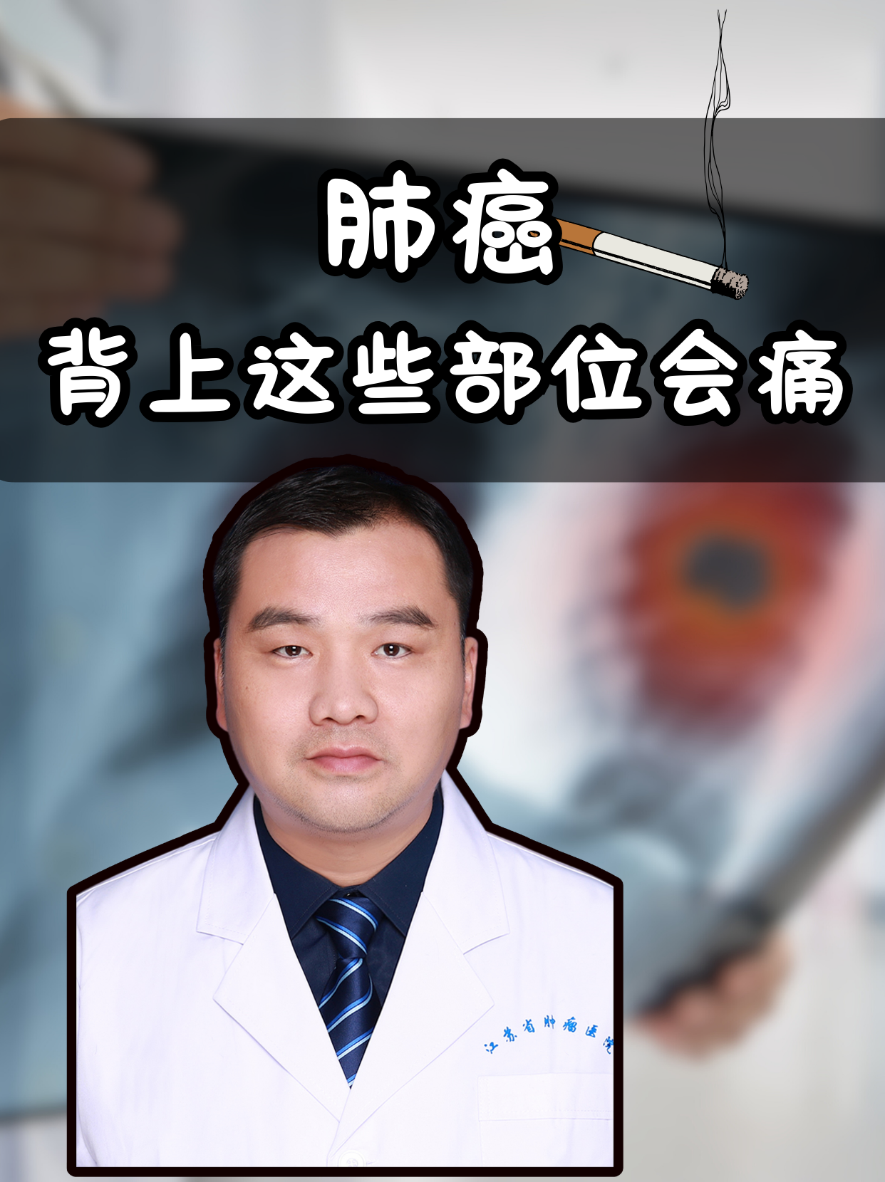 肺癌晚期的症状表现有什么