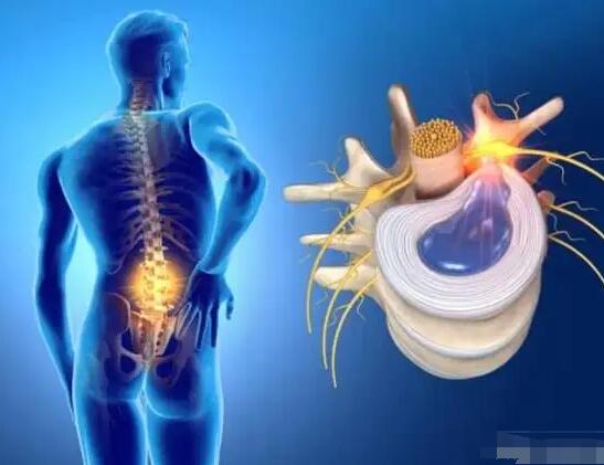 骨量偏高是好是坏,怎么办呢