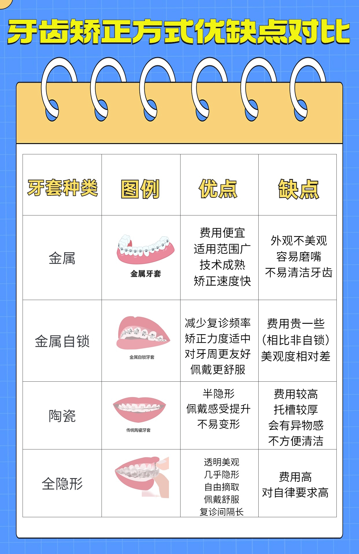 隐形牙套整牙多少钱