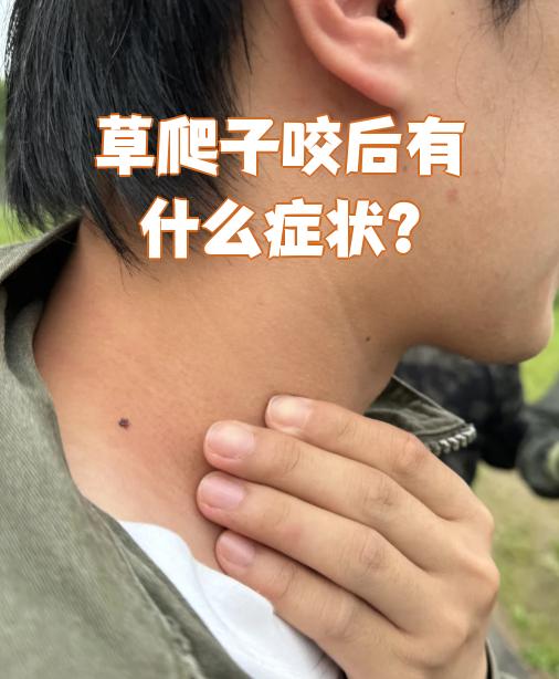 被草爬子咬了怎么办