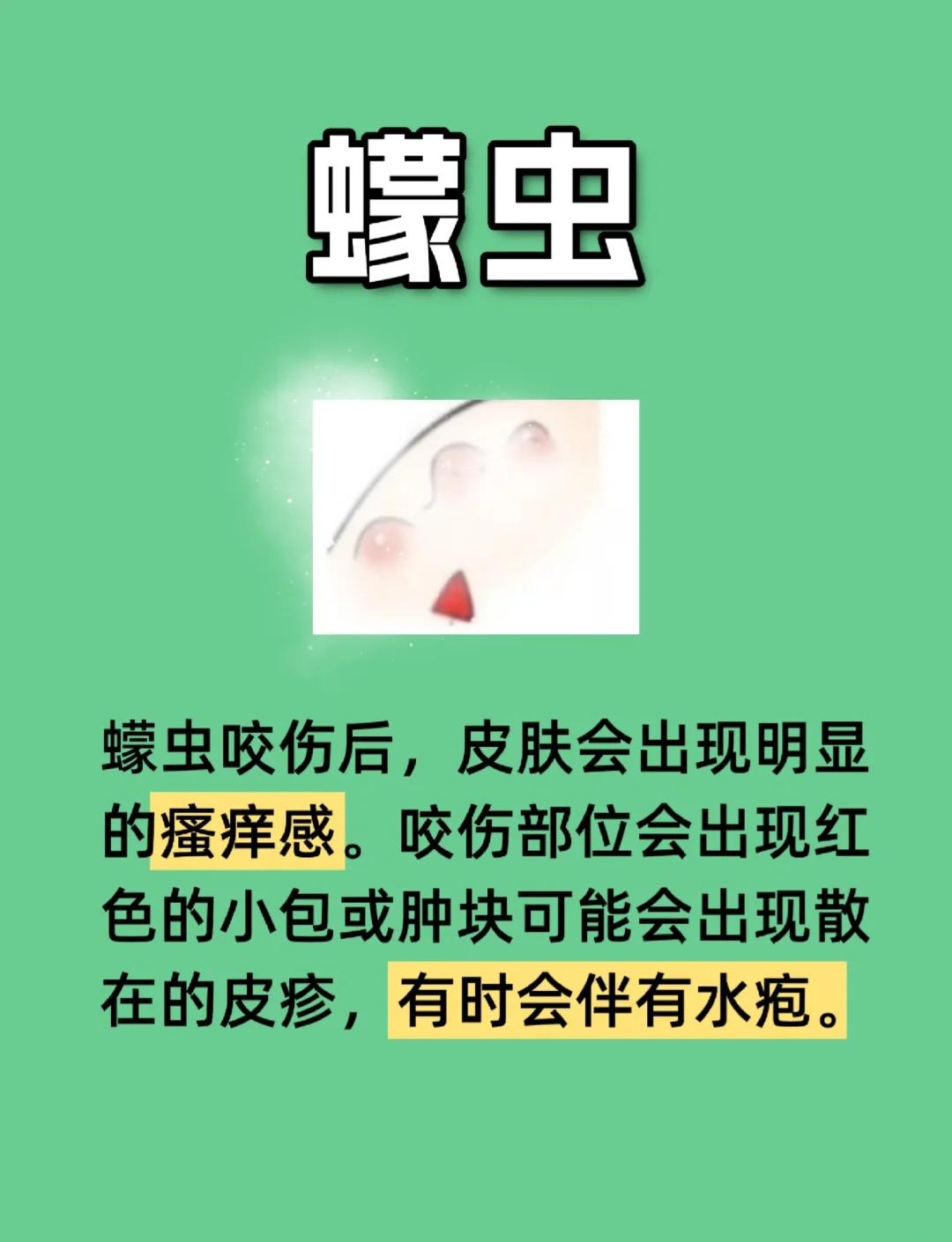 被草爬子咬了怎么办