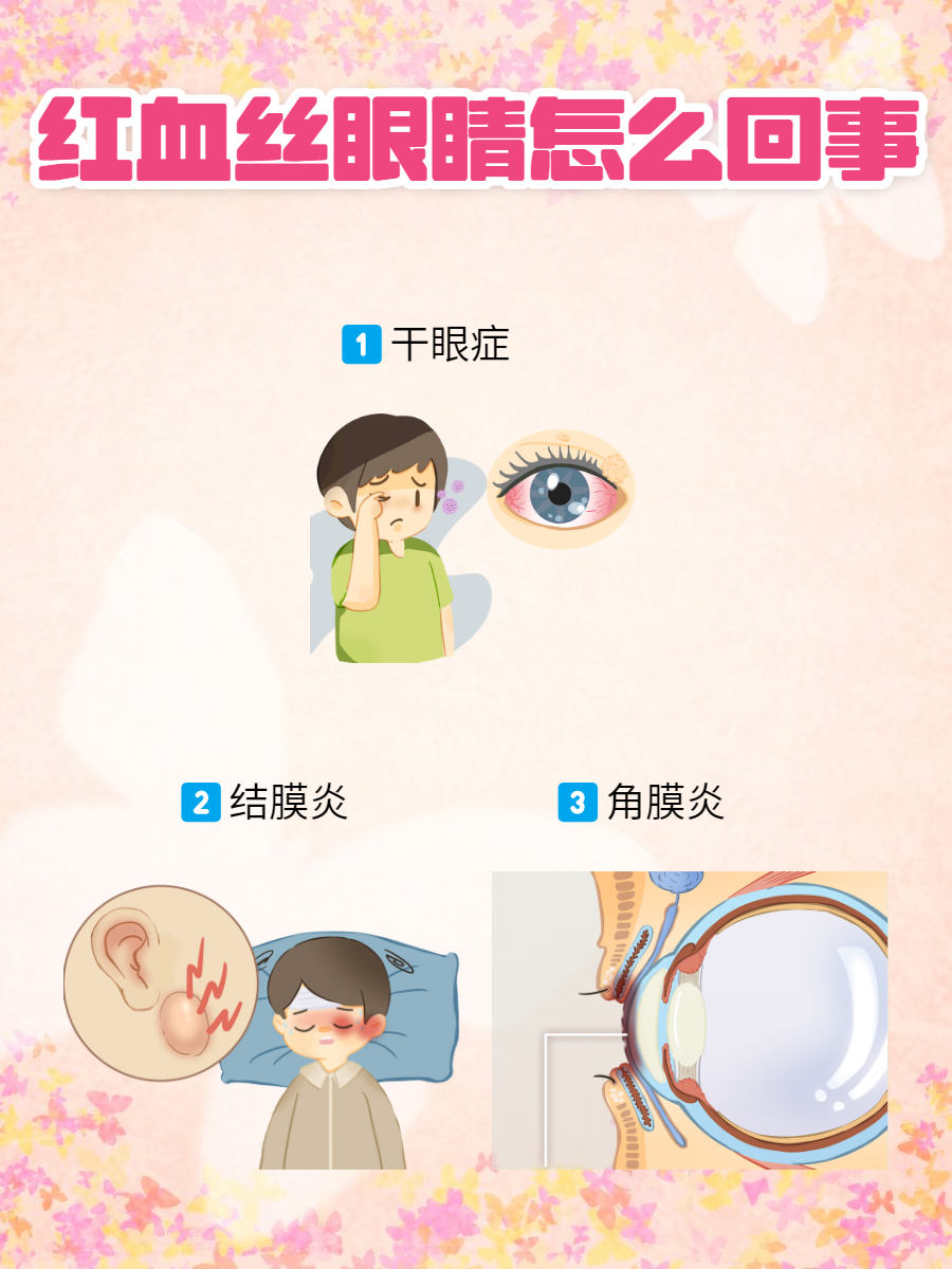 眼睛受伤了,有瘀血怎么办