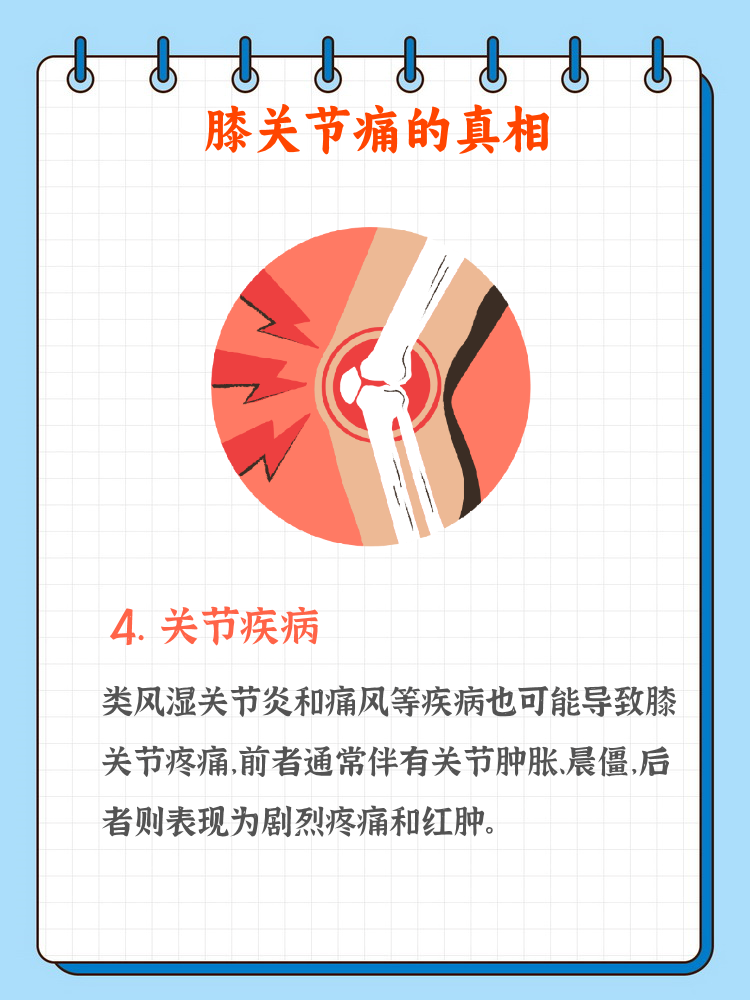 膝盖酸软无力的原因有哪些