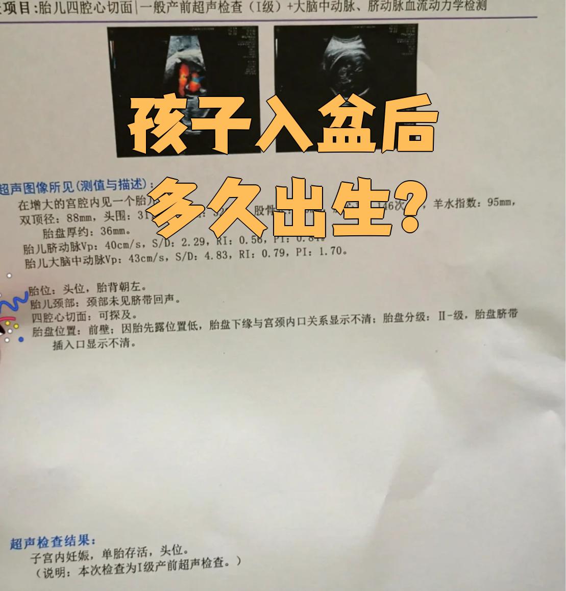 胎儿入盆后什么时候生