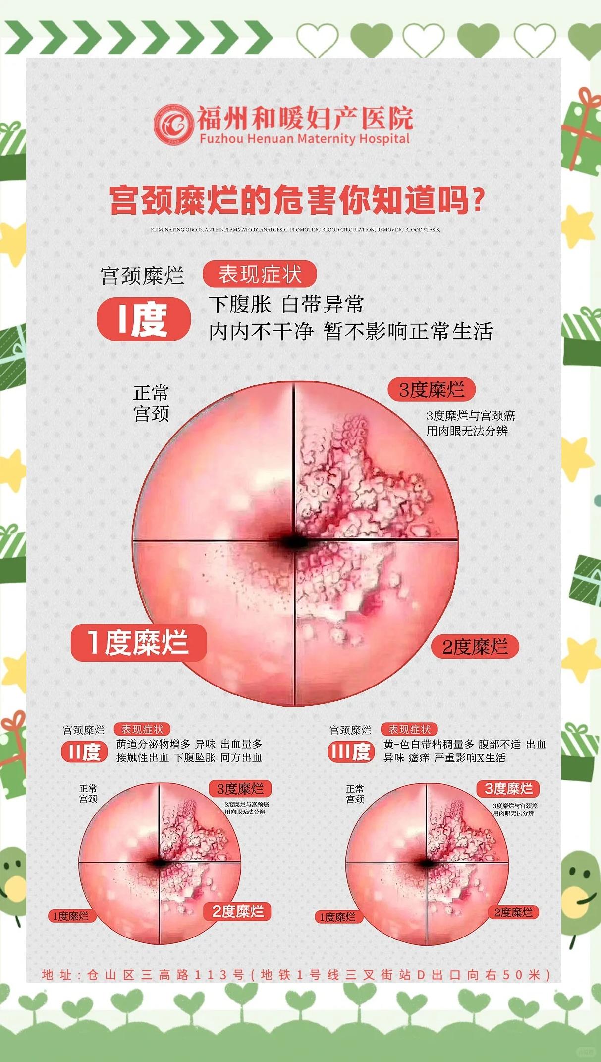 宫颈糜烂不治后果会怎样