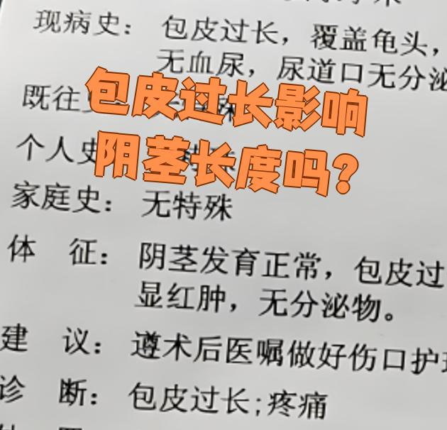 包皮过长会引起早泄吗