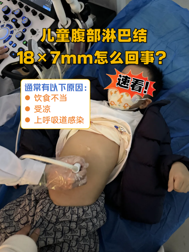 小孩肠梗阻症状是什么样