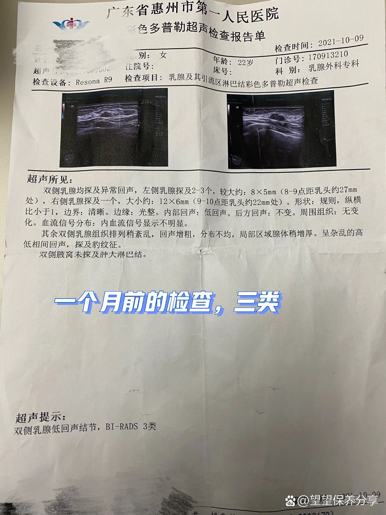 乳腺纤维瘤手术费用