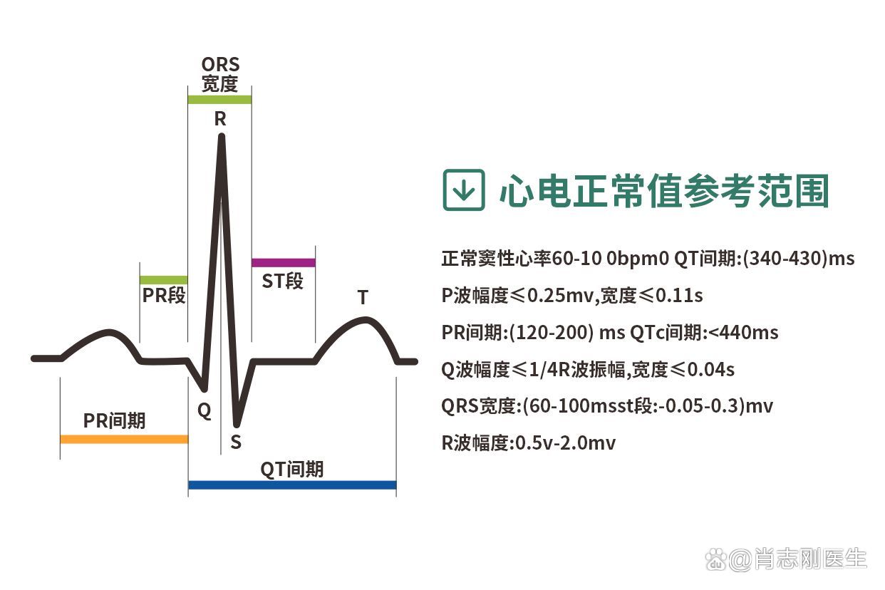 窦性心律是什么意思