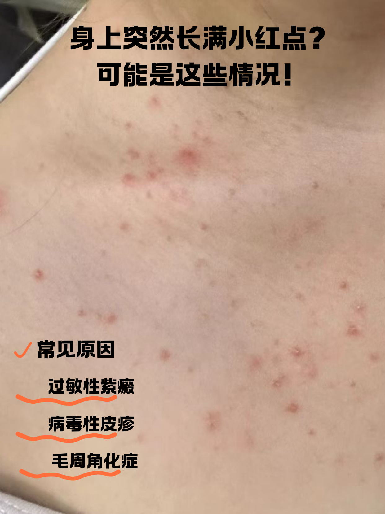 身上起小红点,不疼不痒