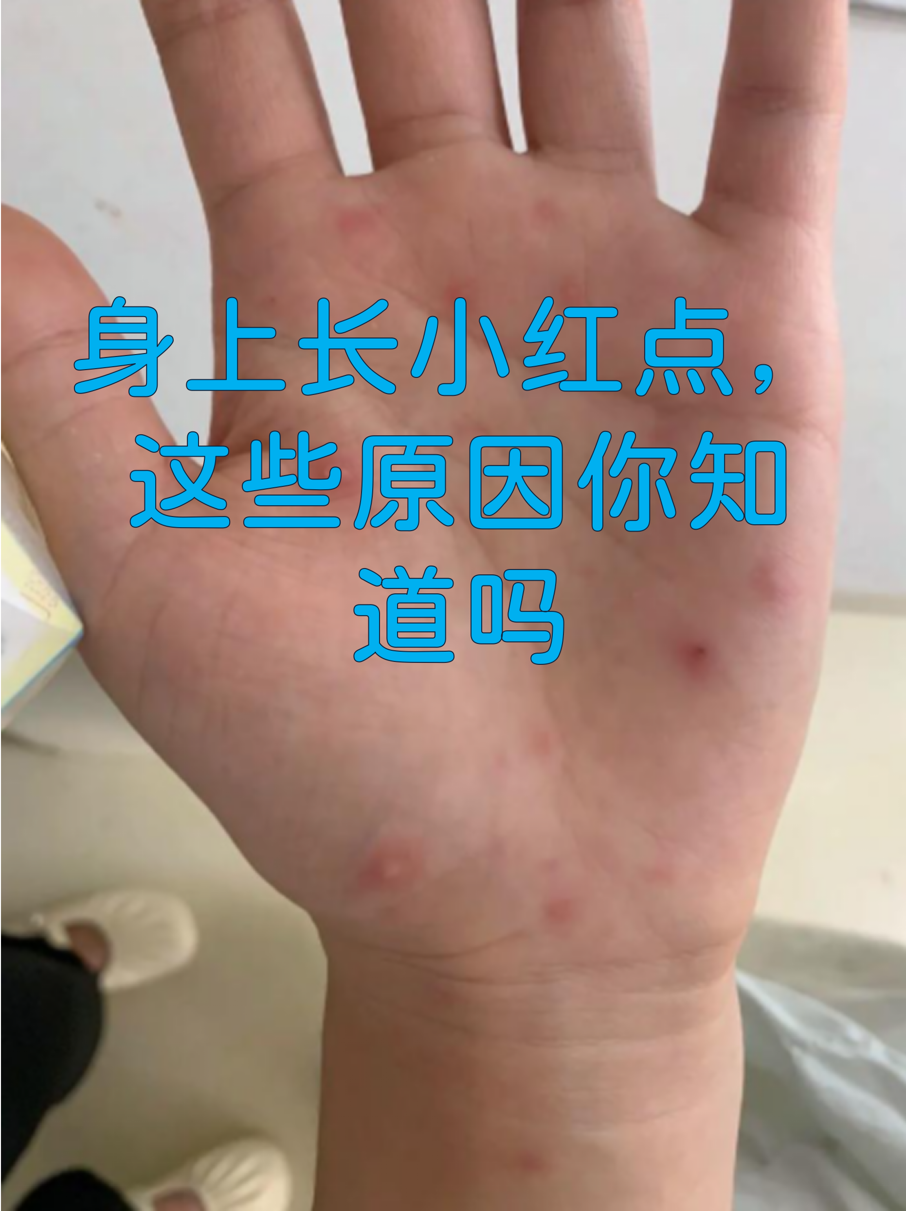 身上起小红点,不疼不痒