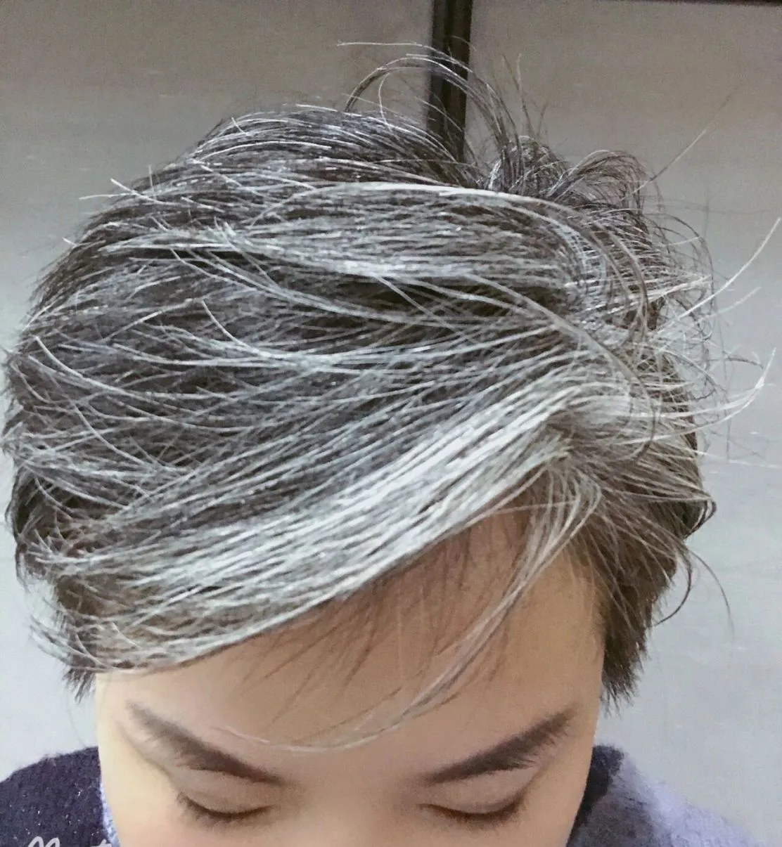 头发白了很多是怎么回事