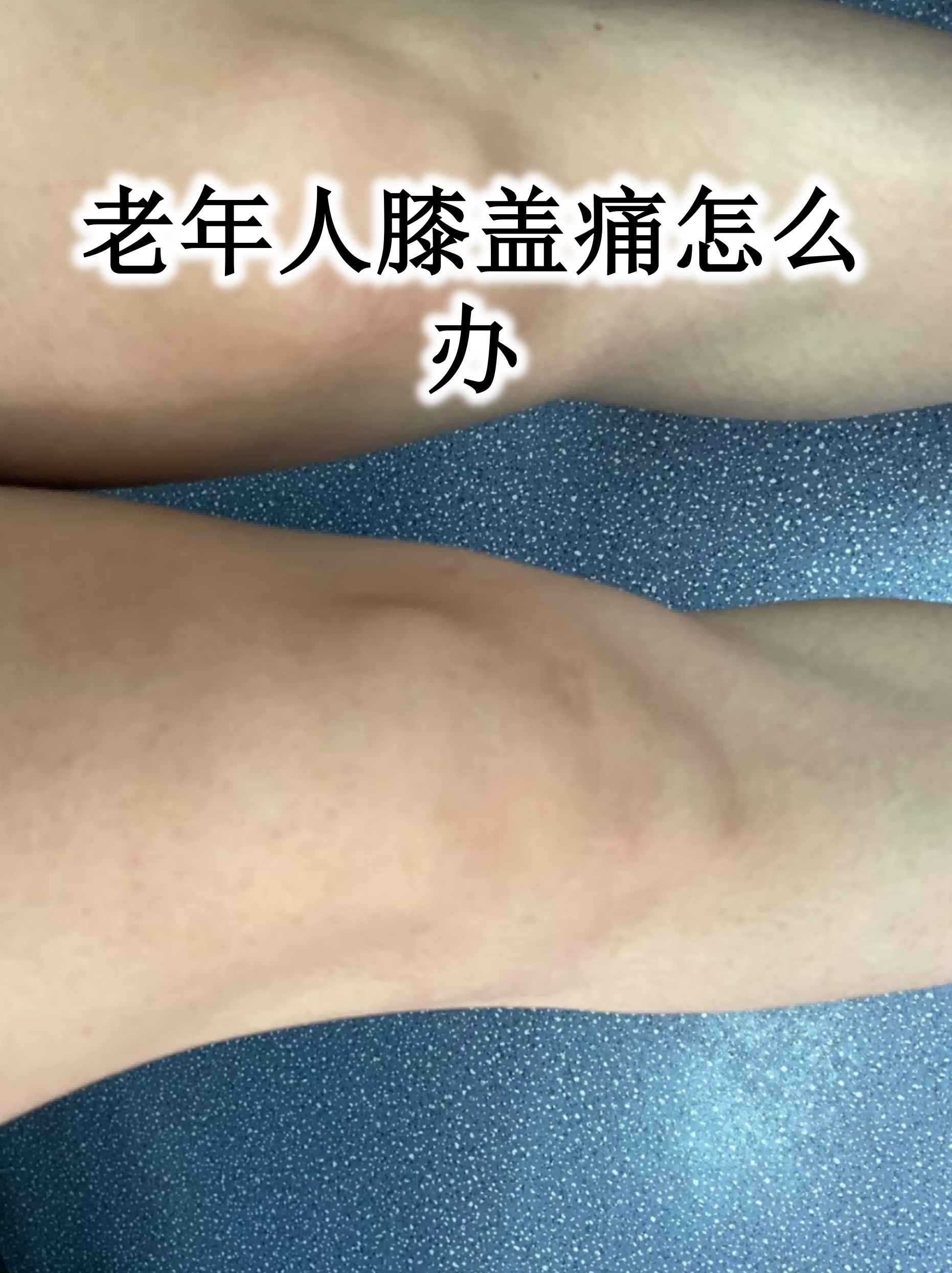 膝盖突出一块骨头正常吗