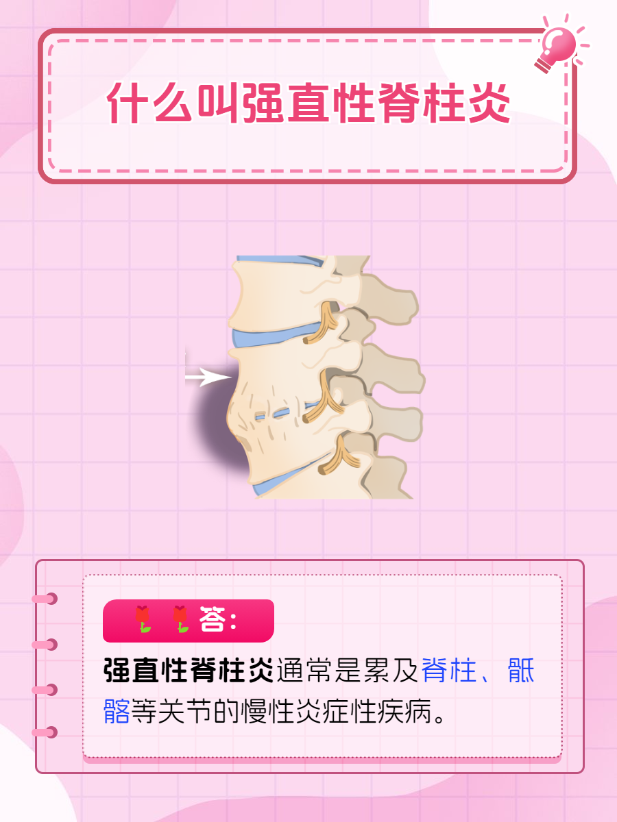 得了脊椎炎能活多久?