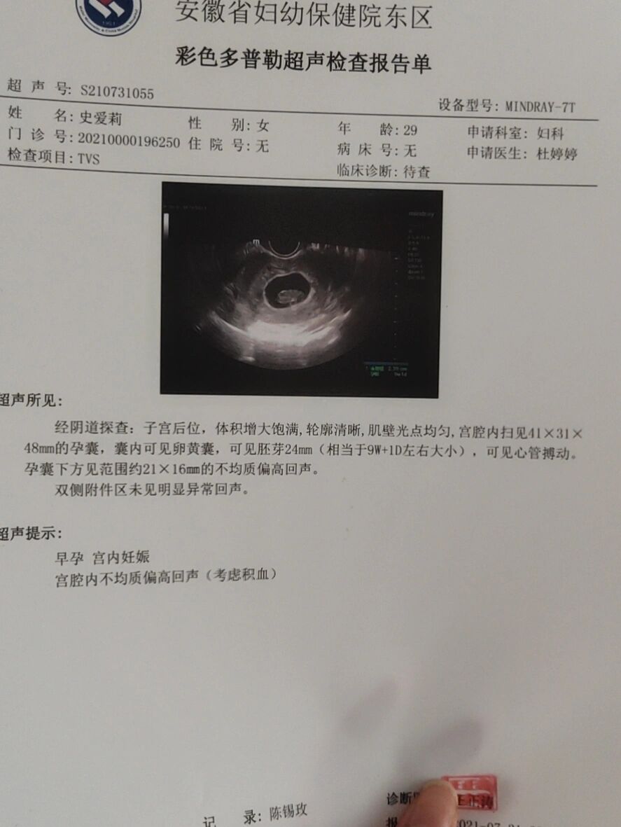 先兆流产的孩子能要吗?