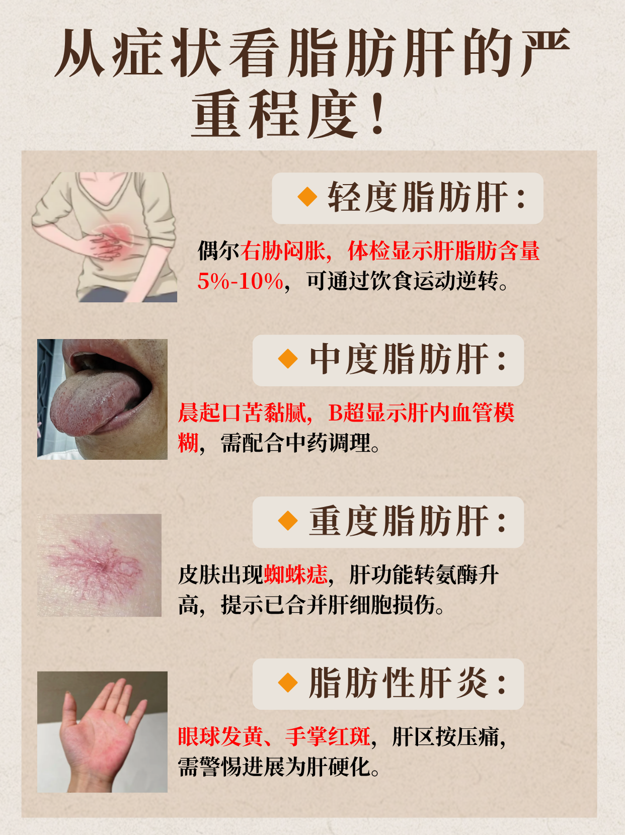 脂肪肝是如何形成的?