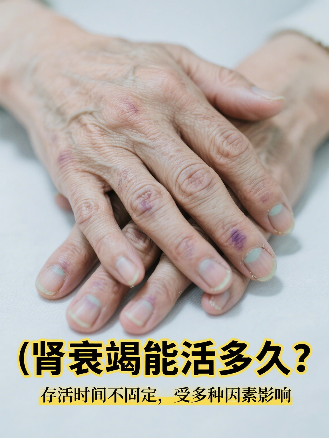 肾功能不全能活多久?