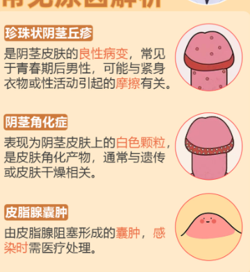 你好,我龟头发白,龟头后面的皮变成白色,我发个