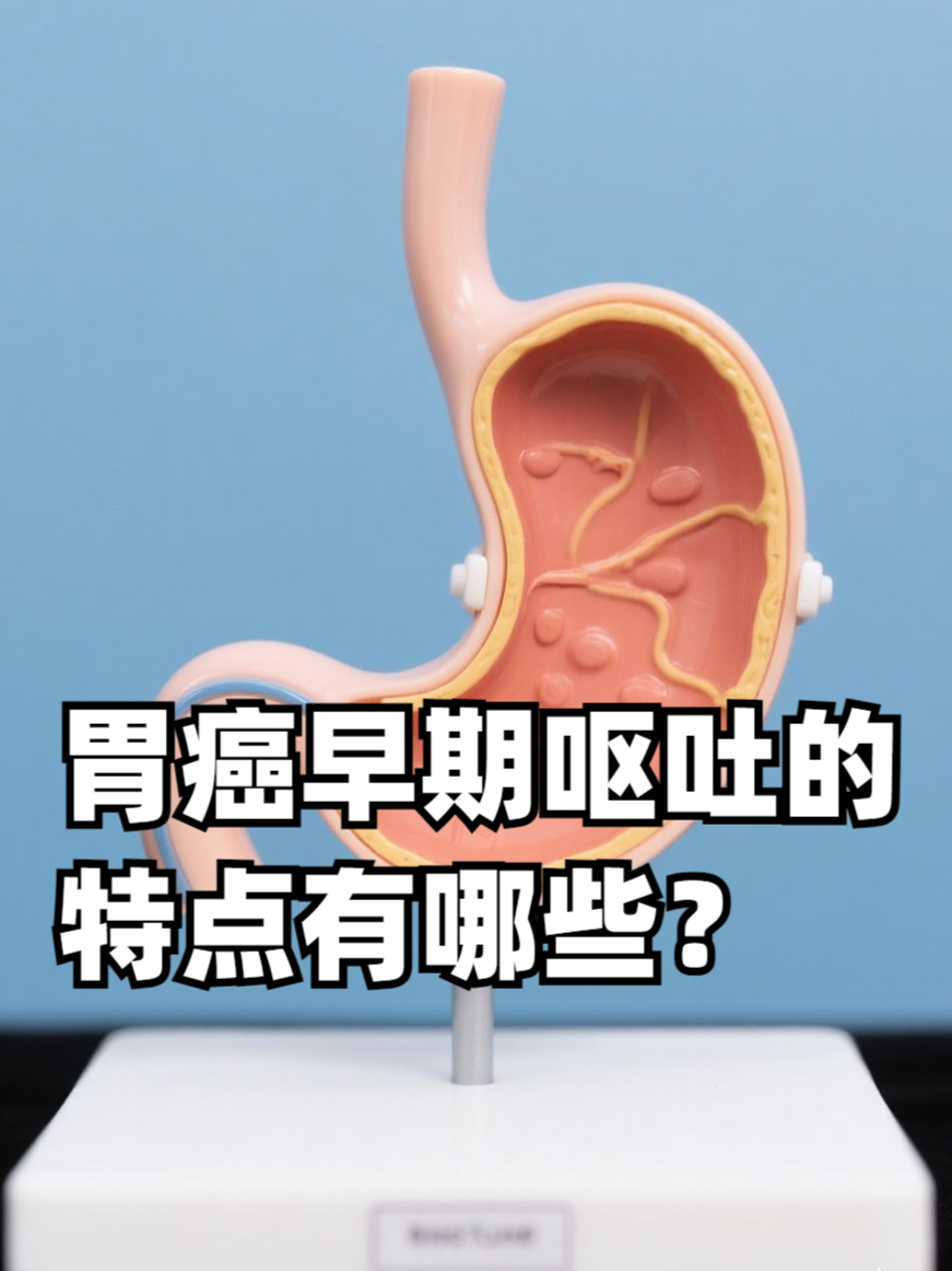 早期胃癌症状有哪些