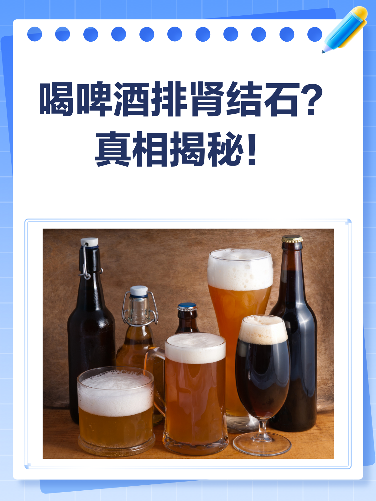 肾结石患者还可以喝酒吗?