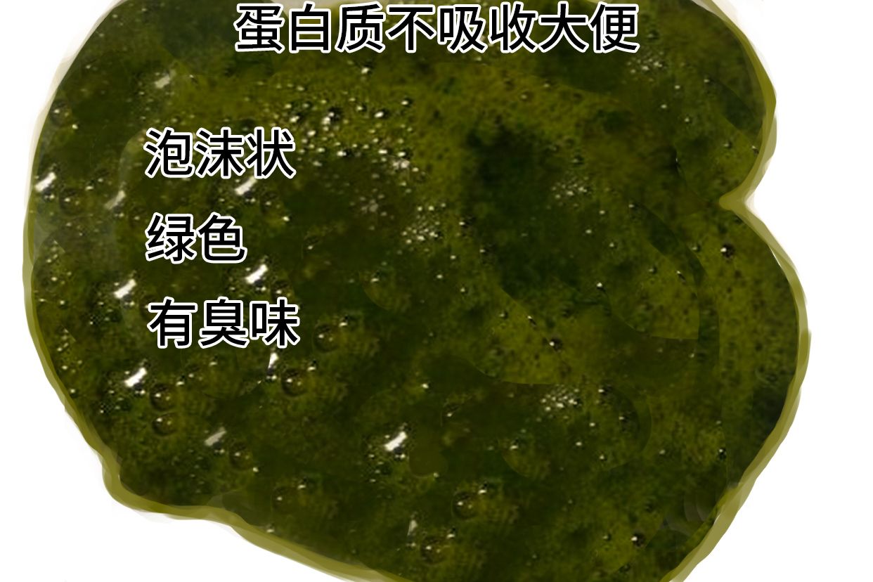 大便绿色怎么回事