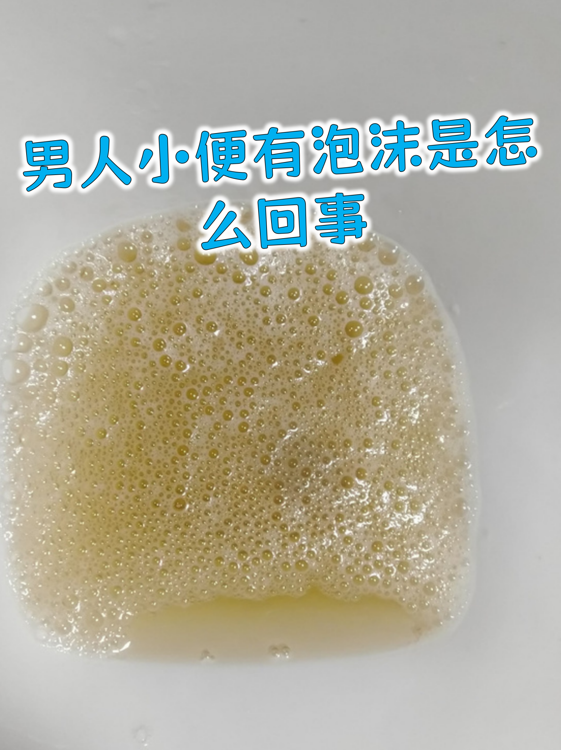 小便不出来是什么毛病