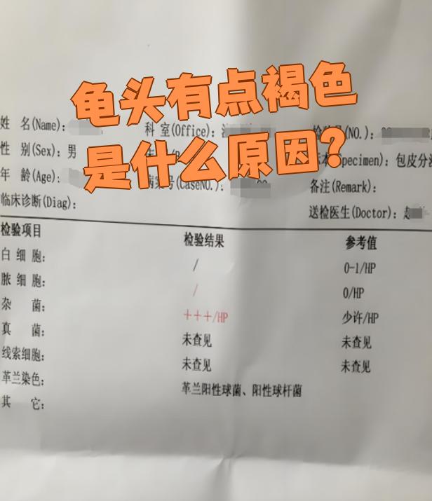 龟头发黑是什么情况?