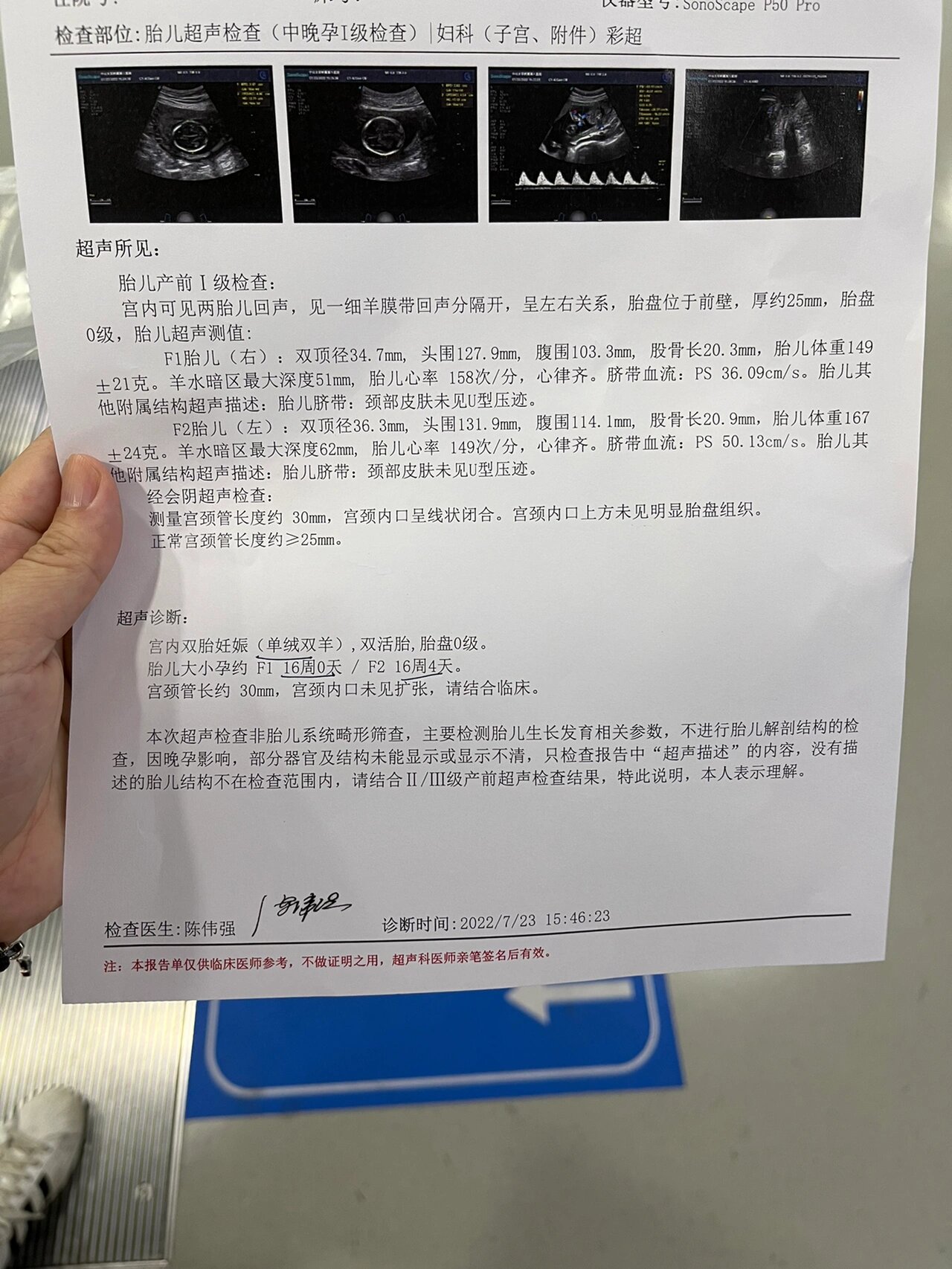 胎儿有u型压迹是男孩吗