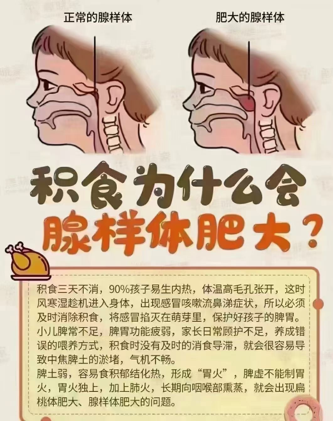 腺样体肥大怎么办