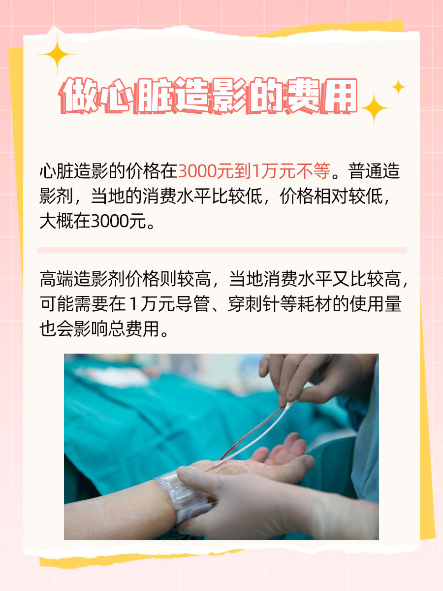 冠状动脉造影的费用