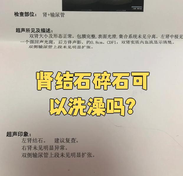 肾结石体外碎石需要住院吗