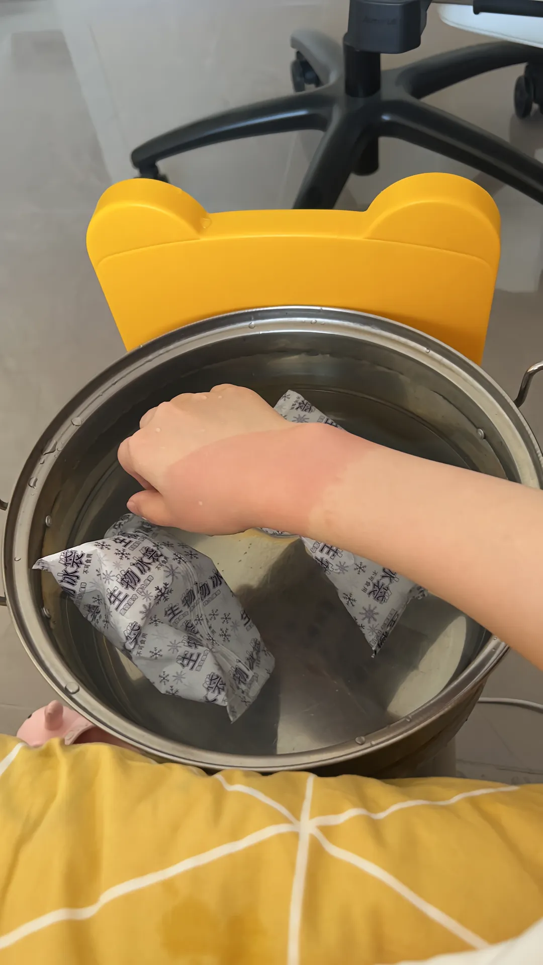 烫伤要多久会好