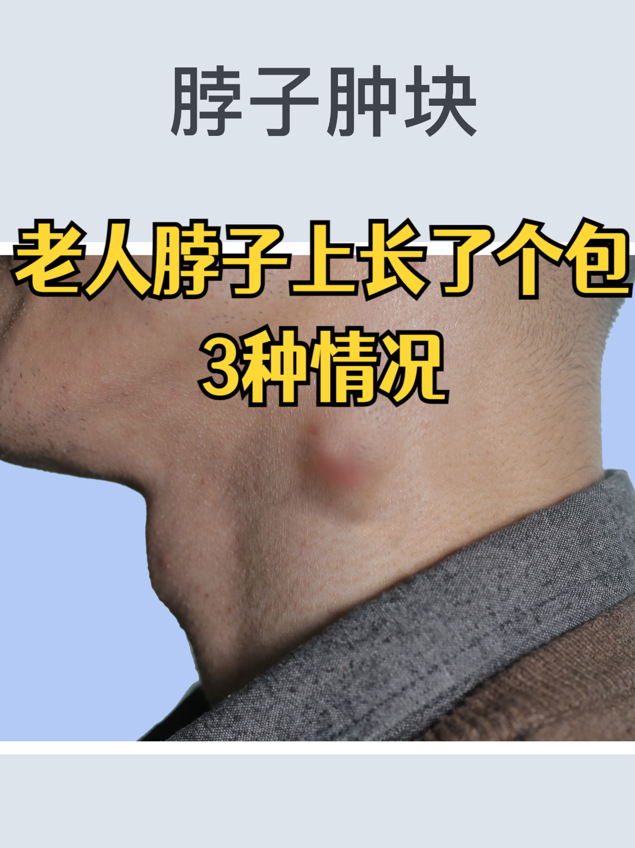 脖子上长了个硬包是什么