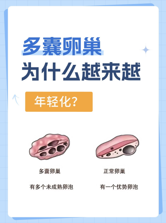 什么是卵巢