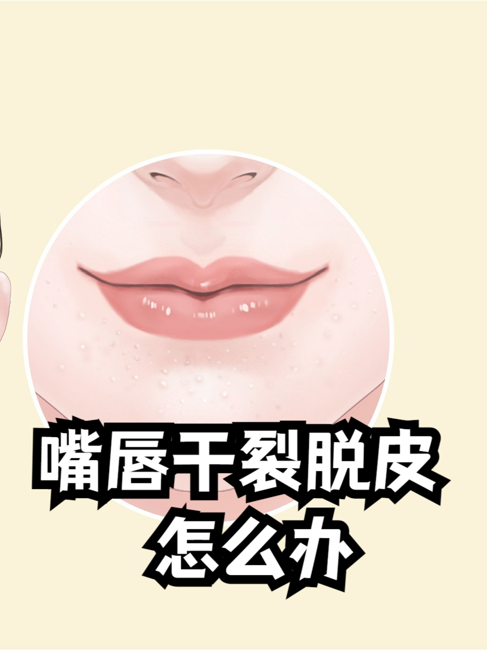 嘴唇特别的干怎么办