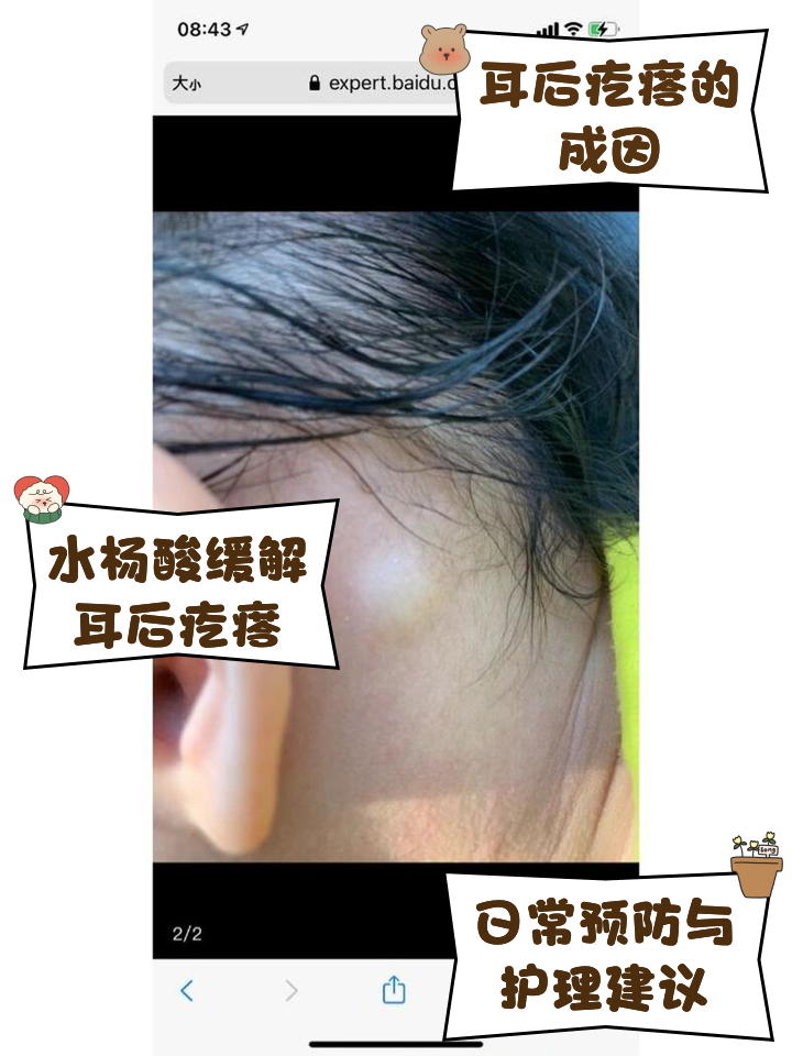 宝宝耳朵后面有个包如何护理