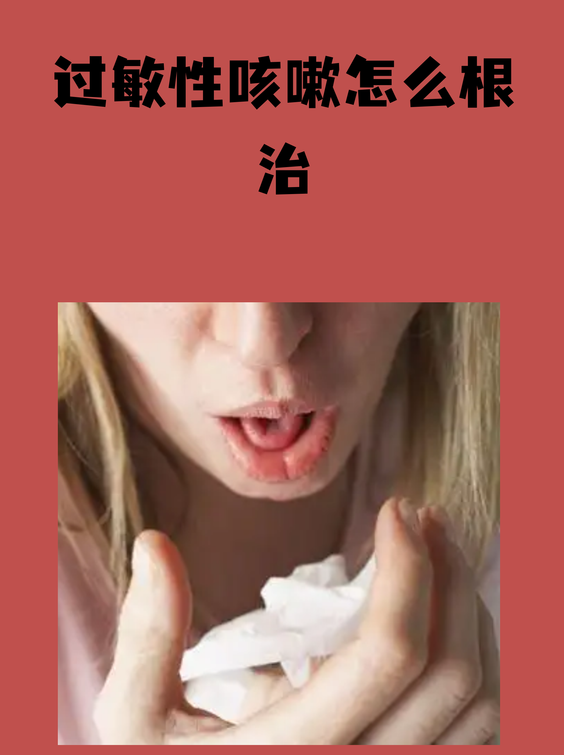 过敏性咳嗽的症状有哪些?