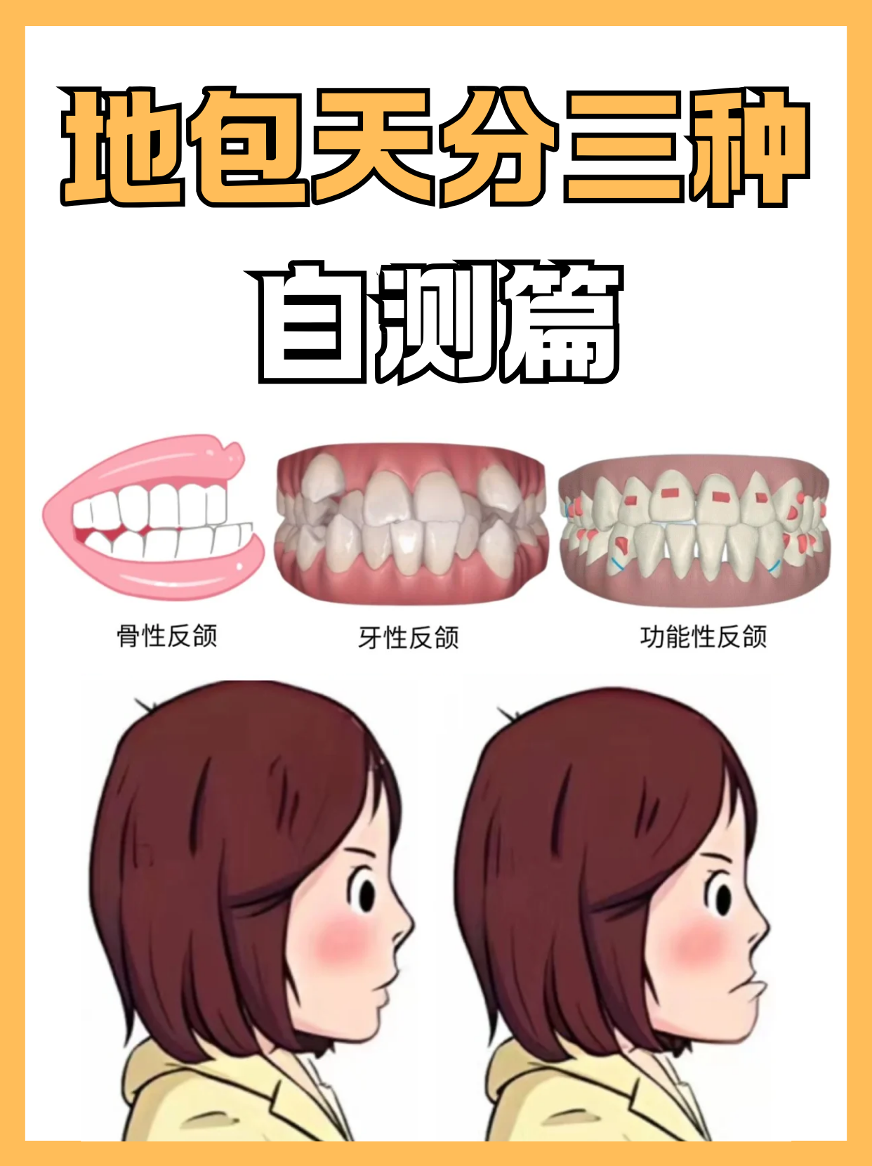 下颌关节紊乱综合征