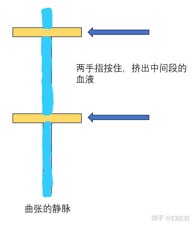测中心静脉压怎么样定位