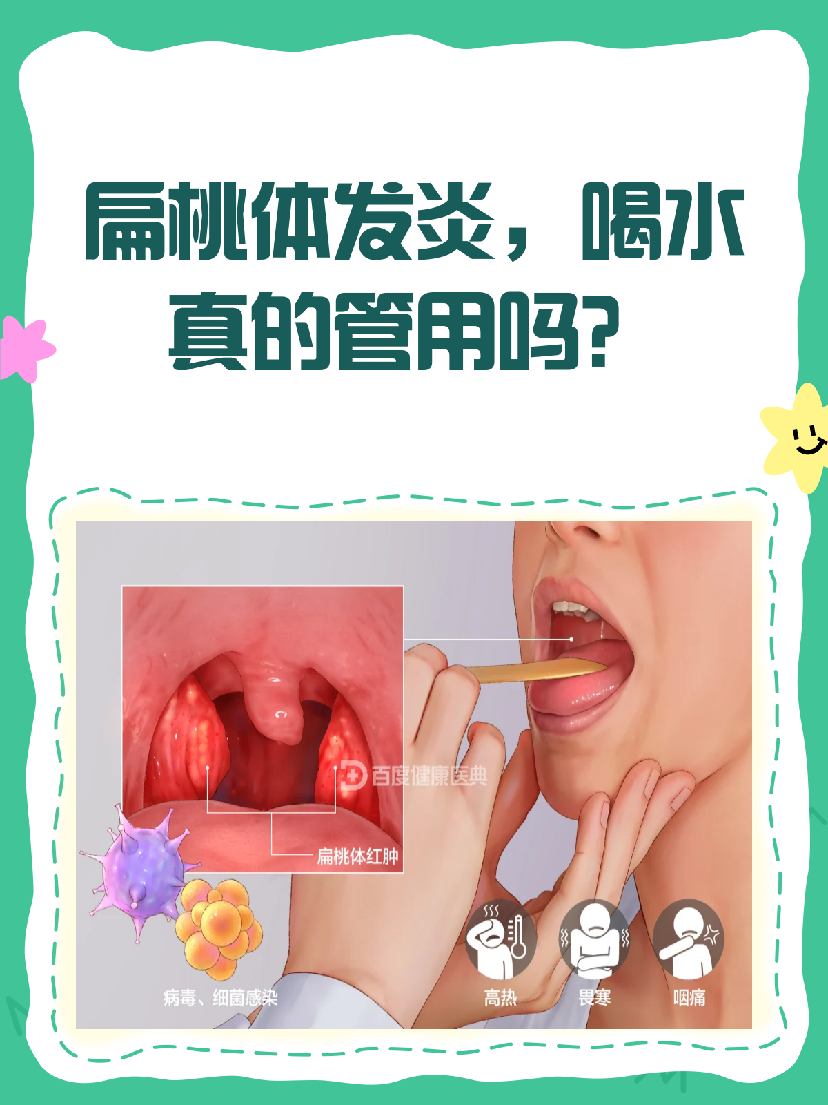 扁桃体发炎,肿大,该怎么办