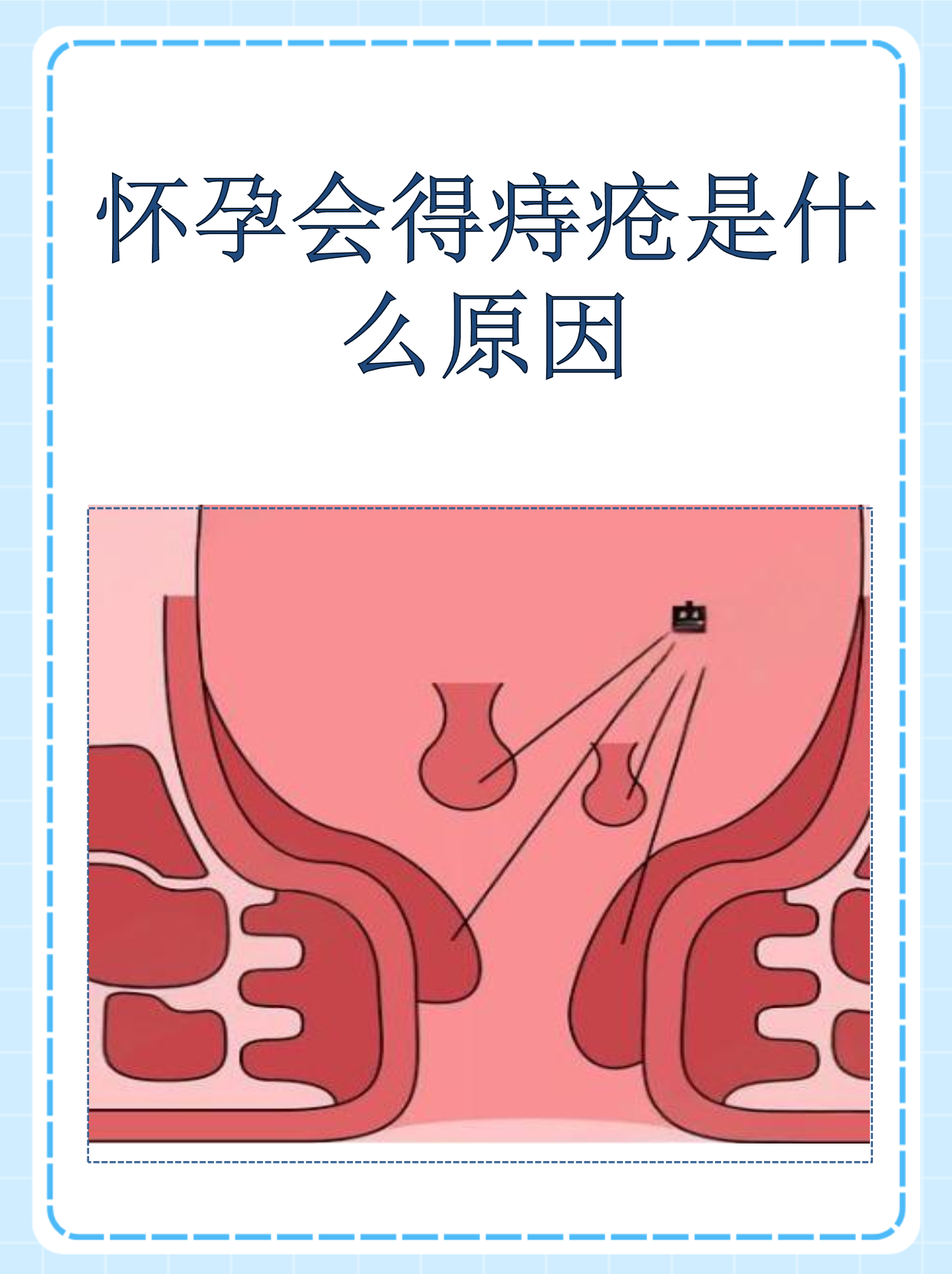 2026年1月4日 第24页