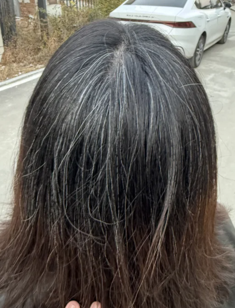 少白发能治好吗?