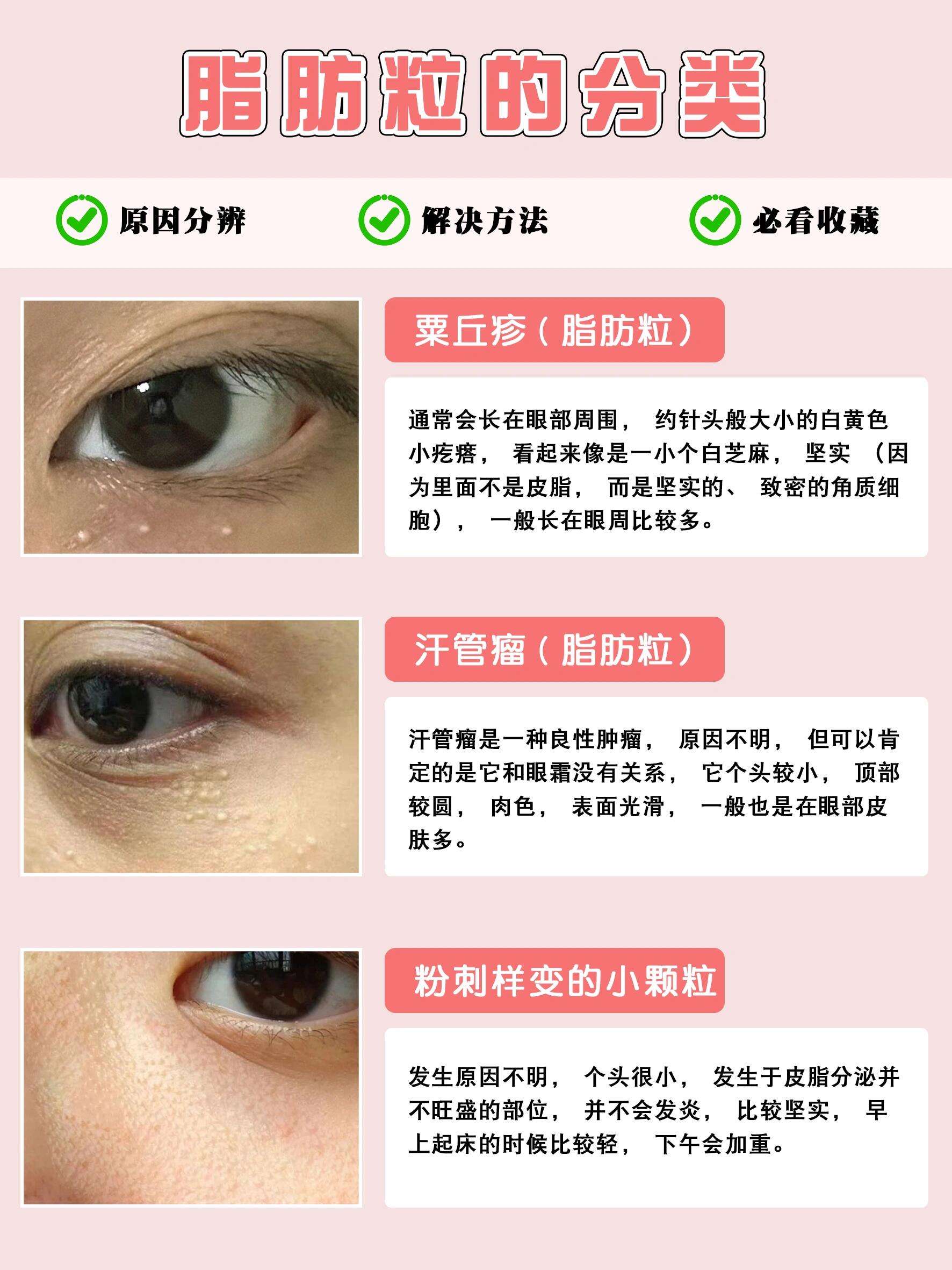 脸上有小肉粒怎么回事